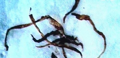 モルゲロン病は存在し、遺伝子組み換え作物に関連している可能性がある