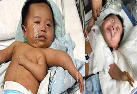 3本の腕を持つ少年